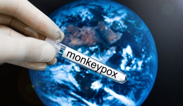 Illustration de l'article Variole du singe : mobilisation des professionnels de santé