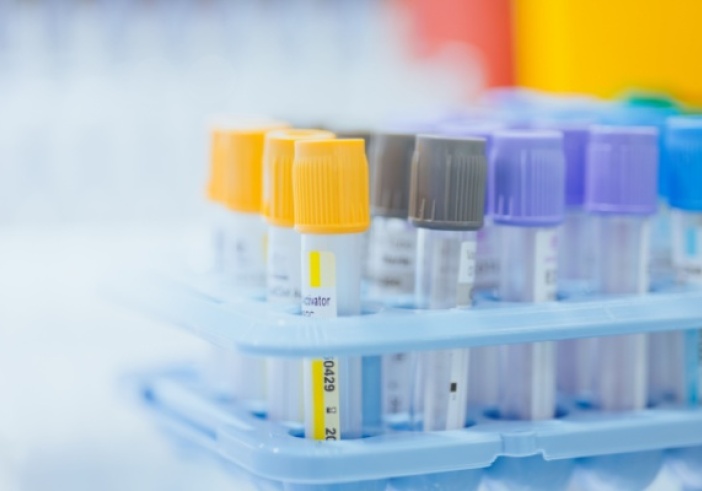 Illustration de l'article : Professionnels de santé : du nouveau pour les examens biologiques