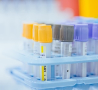 Illustration article : Professionnels de santé : du nouveau pour les examens biologiques